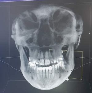 Meet your Posher, Angeline